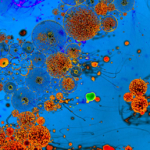 Stress – und seine Folgen für unsere Zellen