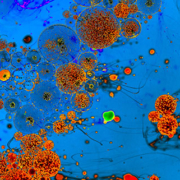 Stress – und seine Folgen für unsere Zellen