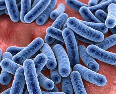 Schleimschicht im Darm – Unser Schutz